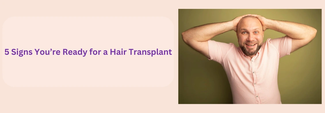 5 Signs You’re Ready for a Hair Transplant