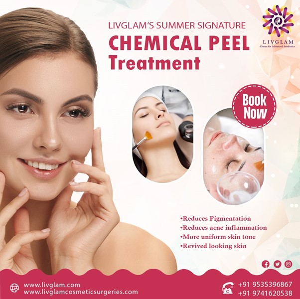Chemical Peel Treatment: Summer Skincare