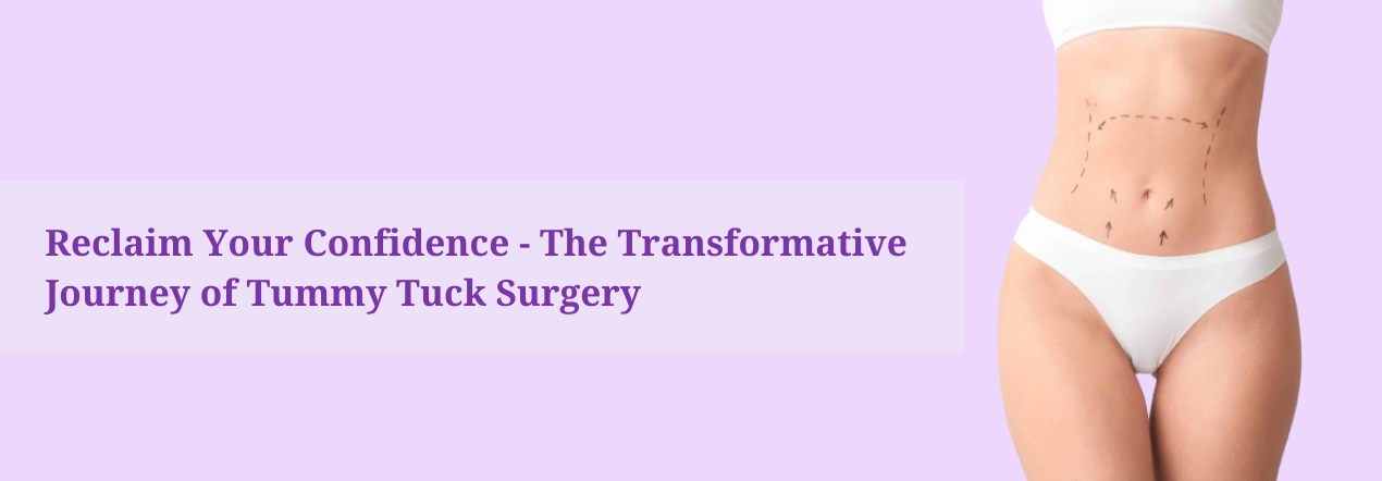 Tummy Tuck Surgery Transformation