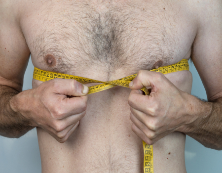 Gynecomastia Surgery Cost in Bangalore